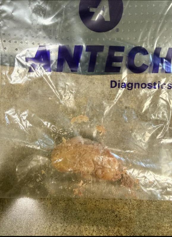 Removed from small intestine. The jejunum