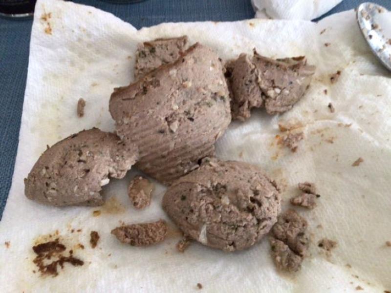 Look at all the bone pieces.