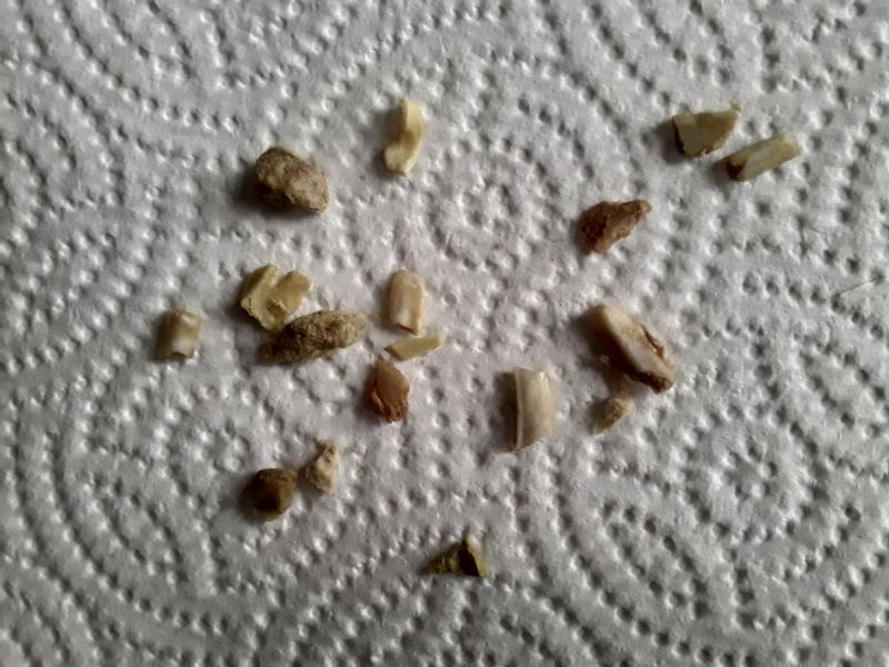Pieces of the bones from my cats vomit.