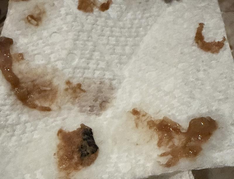 Some of the bone shards from the can.