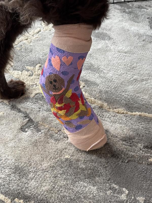 Cast and bandage after ankle surgery