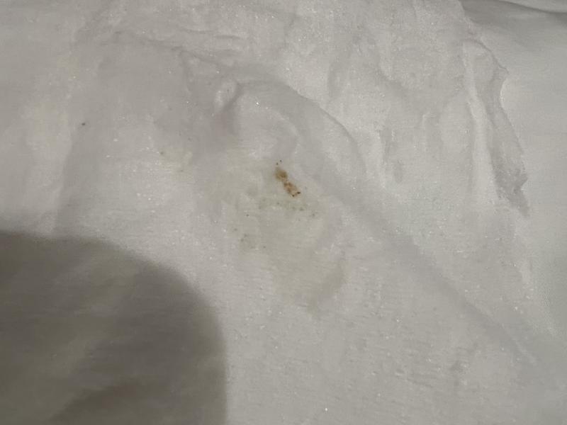 See tartar I was able to get off with the wipe!!