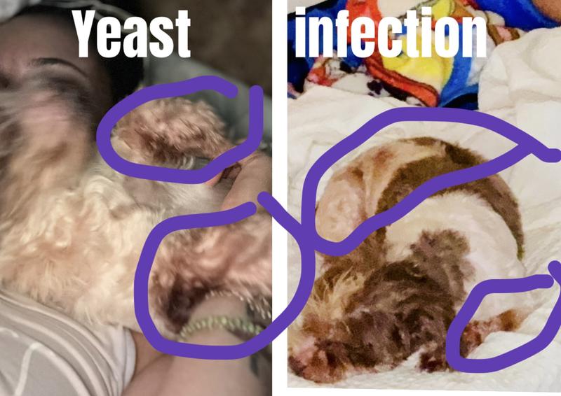 Yeast infection discoloration