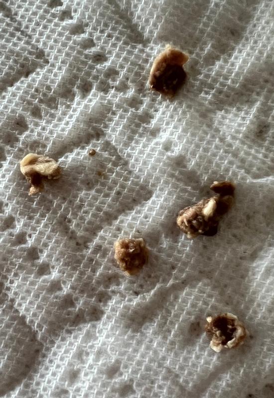 Bone fragments all in the same patty. These are just a few in that one patty. There were more, but these I remembered to save for a photo.