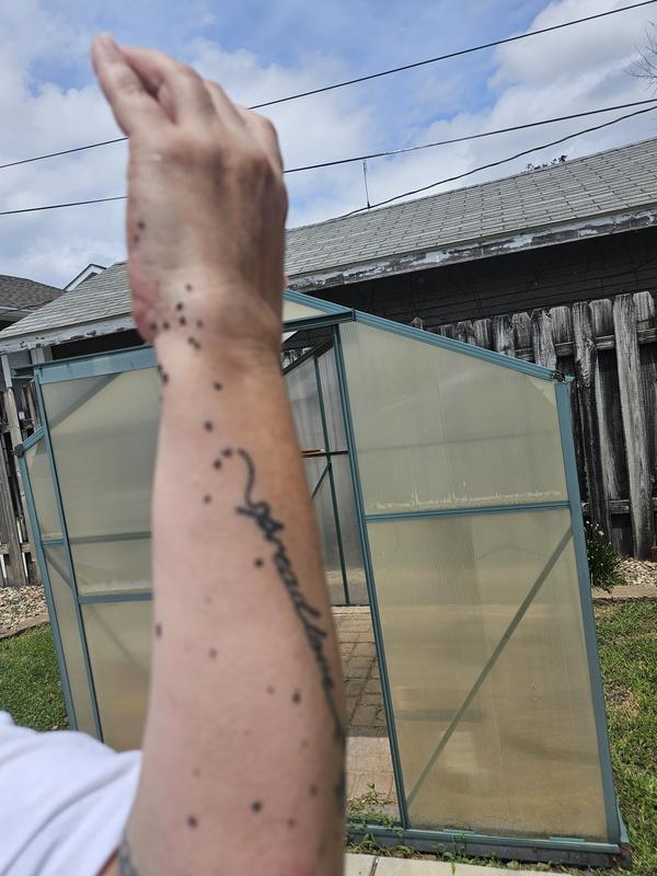 Roofing material on my arms