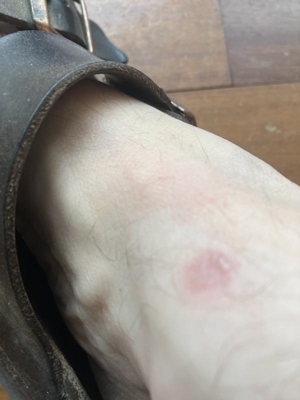 Soreness from wearing these boots