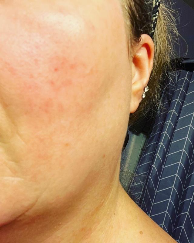 Customer photo for "Impressive Results !!"