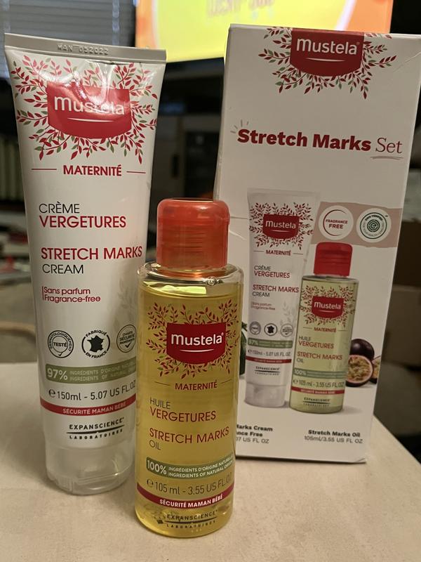 Customer photo for "Goodbye Stretch Marks"