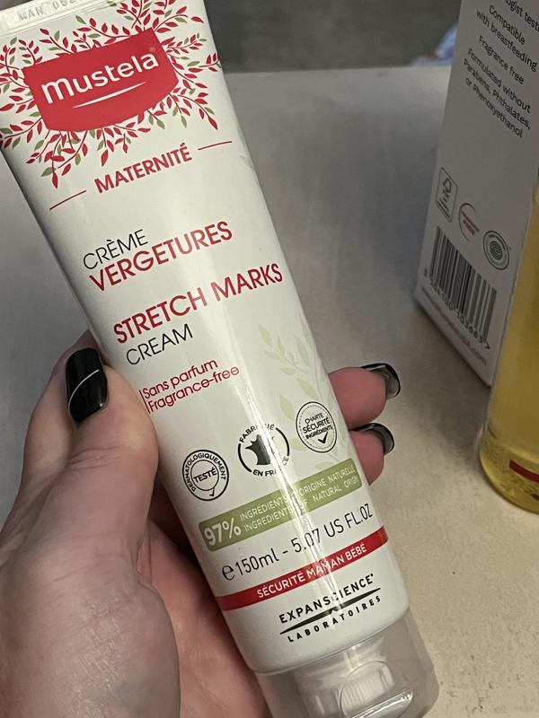 Customer photo for "Goodbye Stretch Marks"