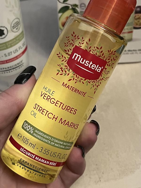 Customer photo for "Goodbye Stretch Marks"