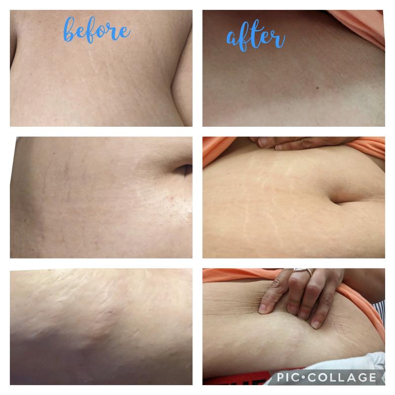 Customer photo for "Progress is being made"