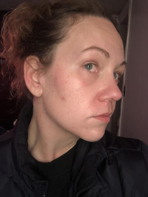 Customer photo for "Solid SPF choice for combination skin"