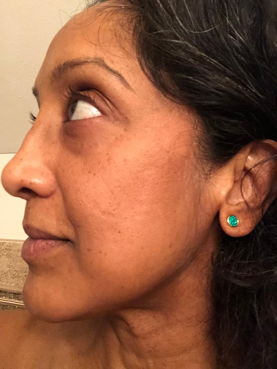 Review Thumbnail Image 0 199693383