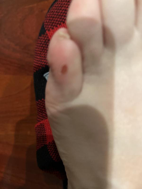 It's like there are thorns on the si