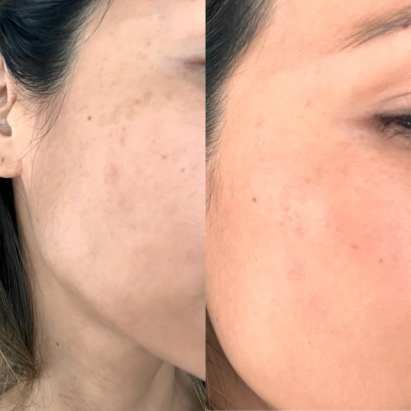 Review Thumbnail Image 0 234729516