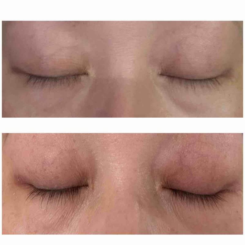 Review Thumbnail Image 0 245955040