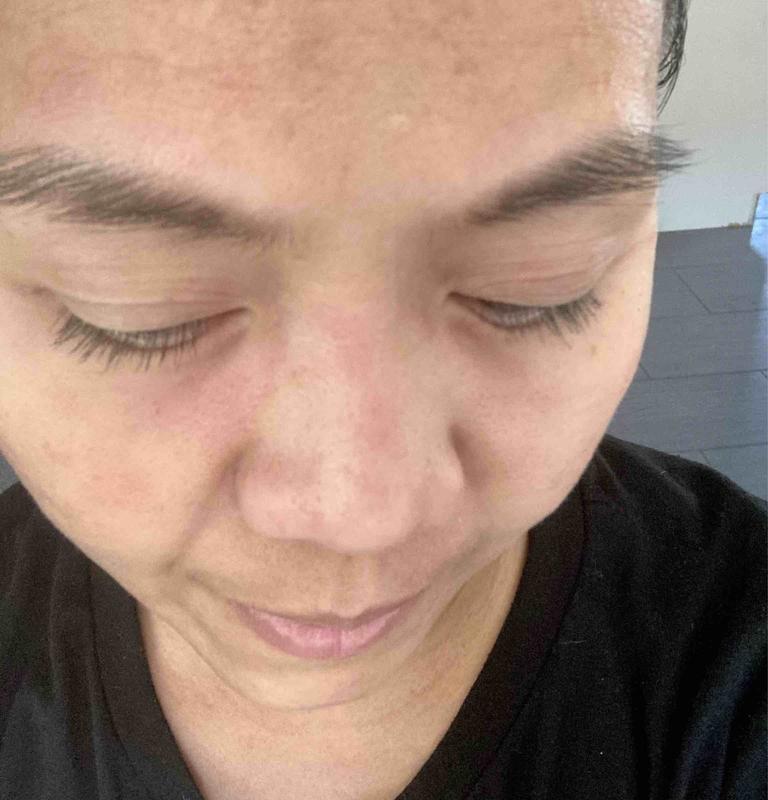 Customer photo for "Gave me rashes"