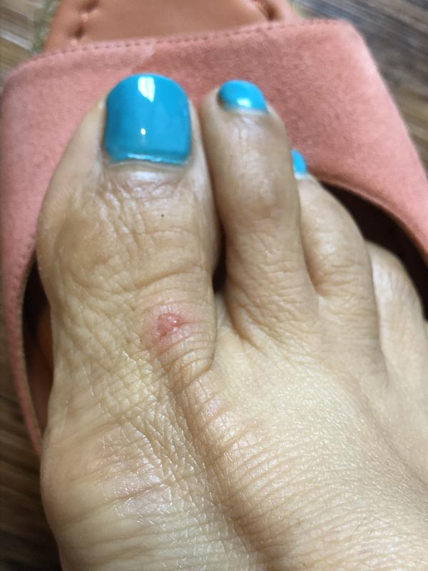 Review Thumbnail Image 0 237267242