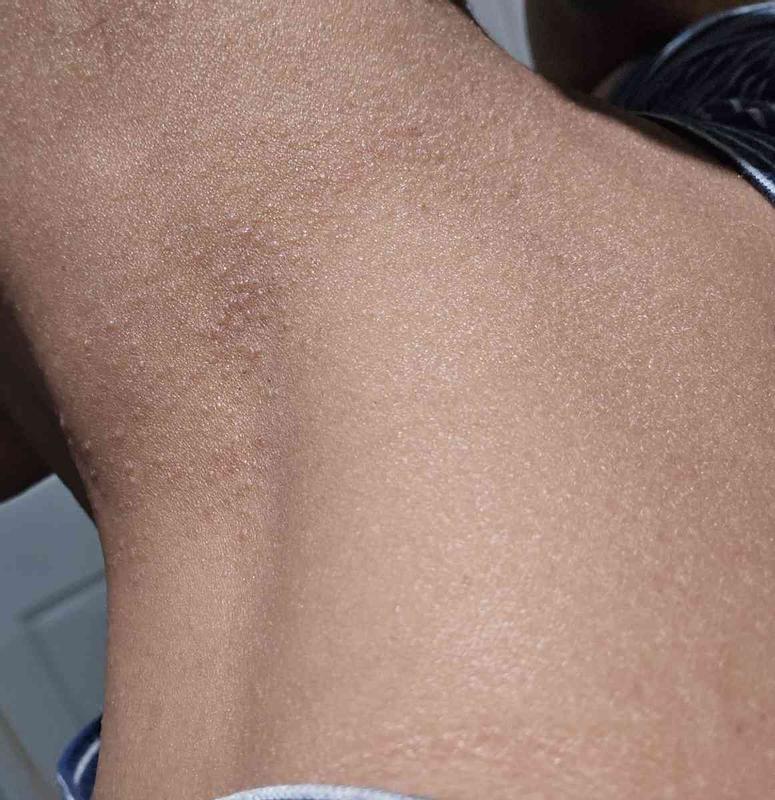 Review Thumbnail Image 0 236988702