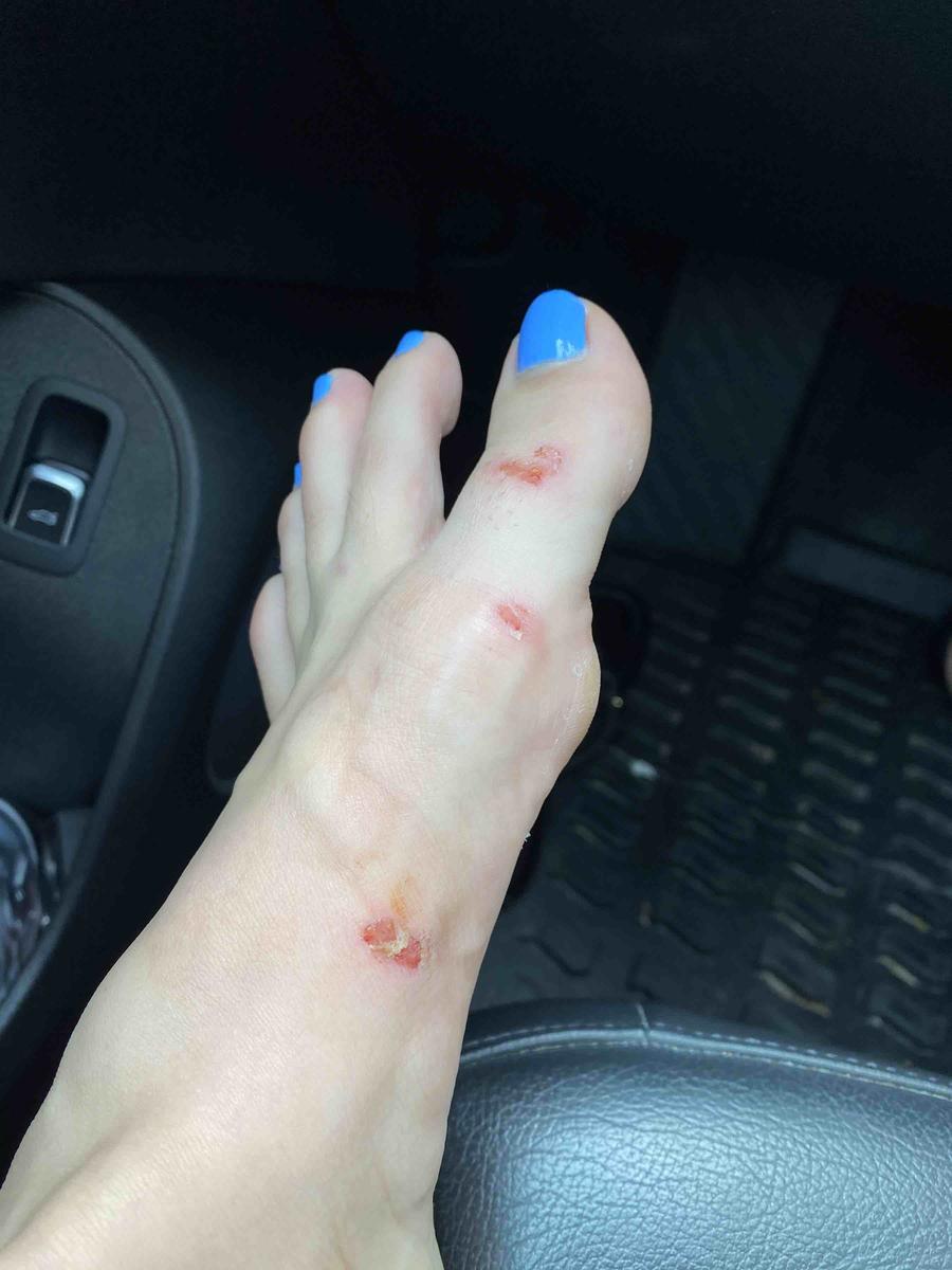 Customer photo for "DO NOT BUY, unless you want cut up feet!"