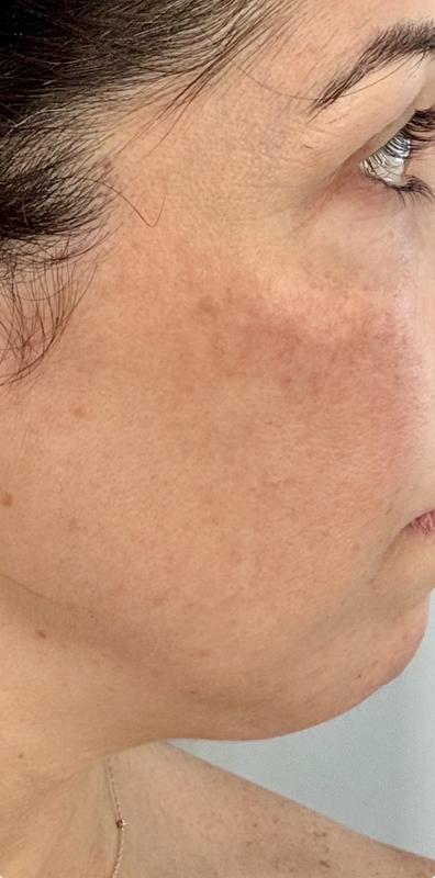 Review Thumbnail Image 1 249406646