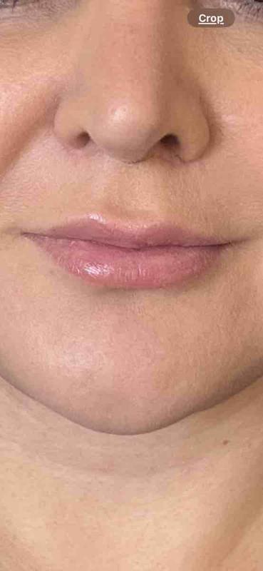 Review Thumbnail Image 0 246515858