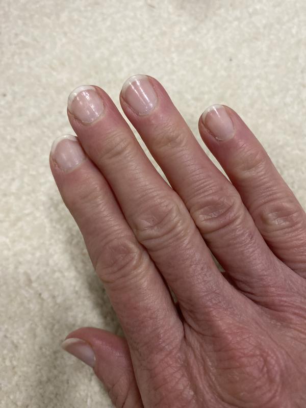 Customer photo for "Best cuticle cream."
