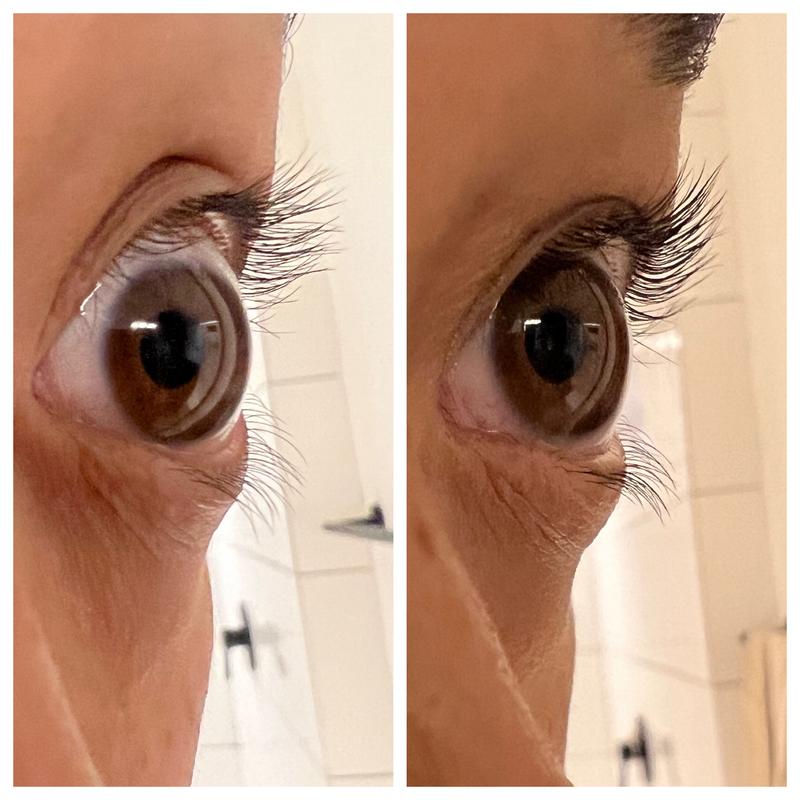 Customer photo for "Quick results"