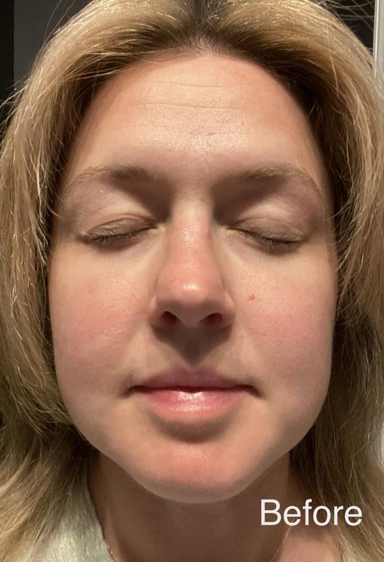 Customer photo for "Gives Skin a Beautiful, Dewy Glow"
