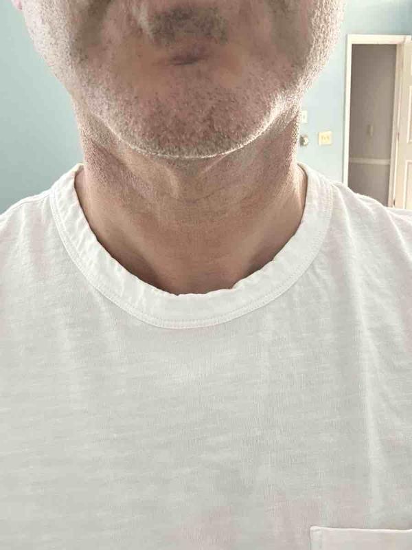 Review Thumbnail Image 0 236312393