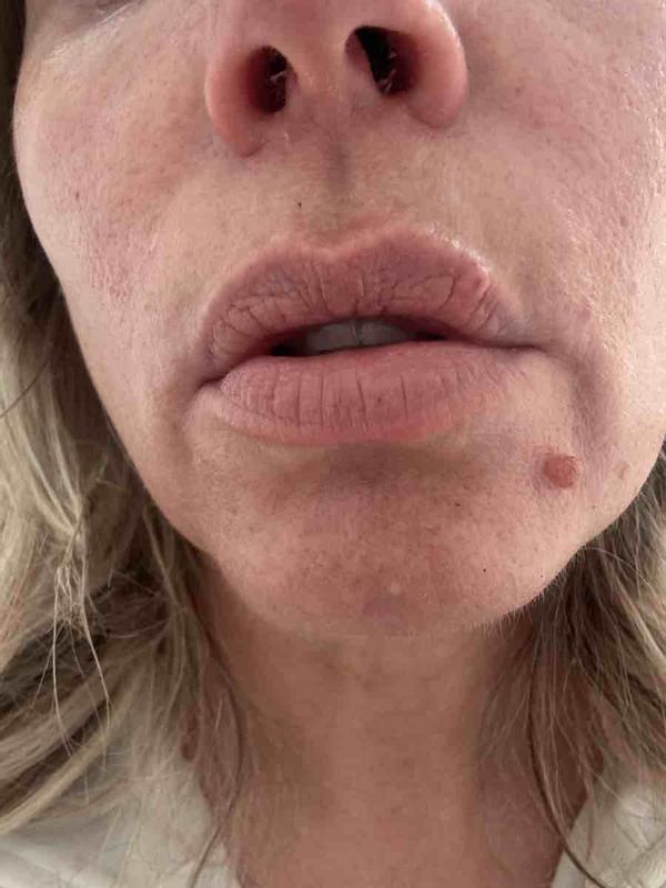 Review Thumbnail Image 0 241649520