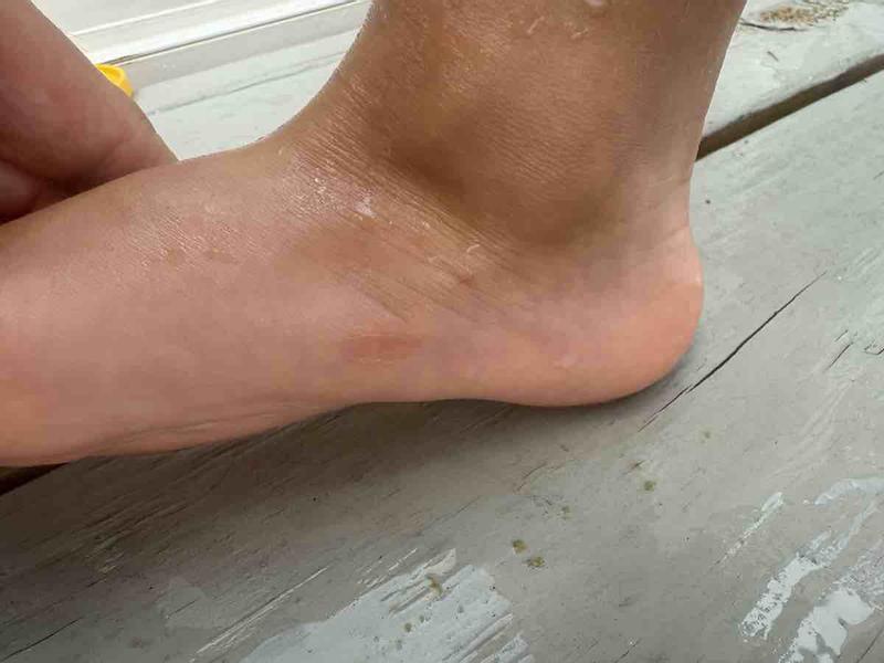 Review Thumbnail Image 0 242915376