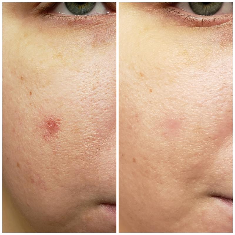 Review Thumbnail Image 0 223004065