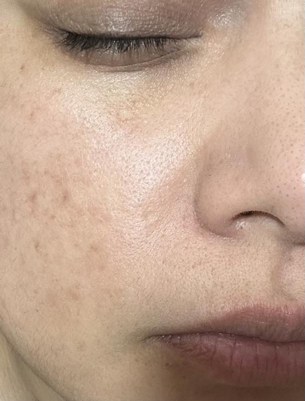 Customer photo for "Youthful appearance"