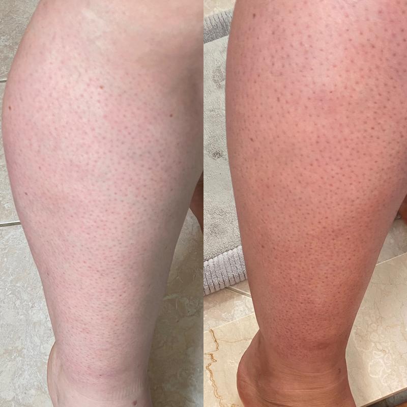 Review Thumbnail Image 0 232341532