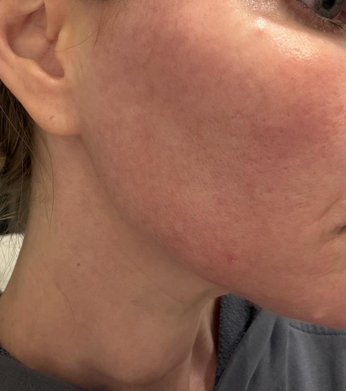 Review Thumbnail Image 0 249087282