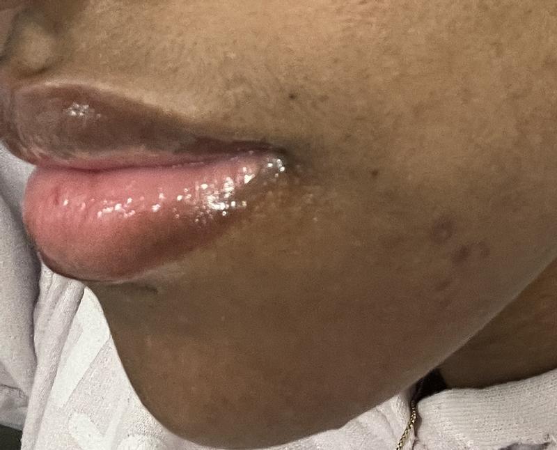 Review Thumbnail Image 0 235058649