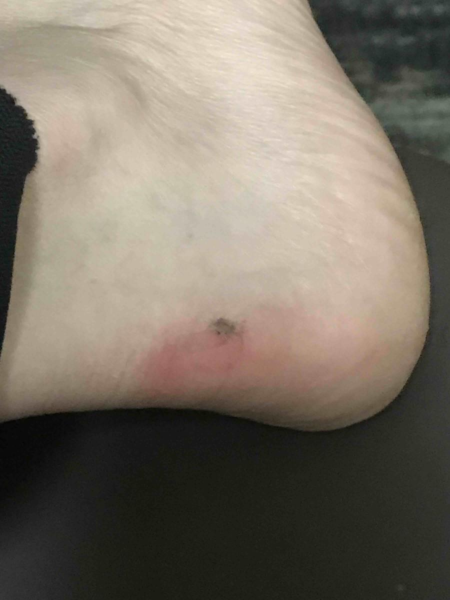 Review Thumbnail Image 0 209164688