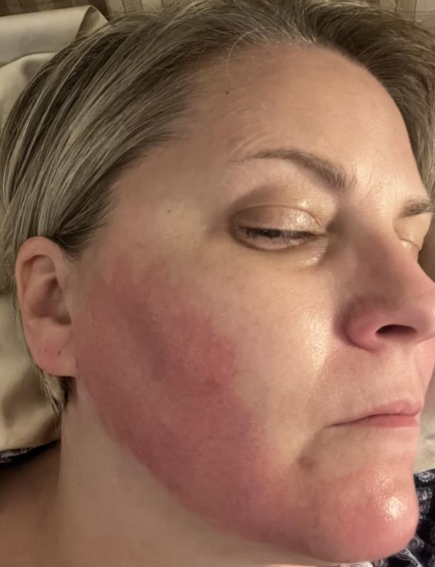 Review Thumbnail Image 0 228586321