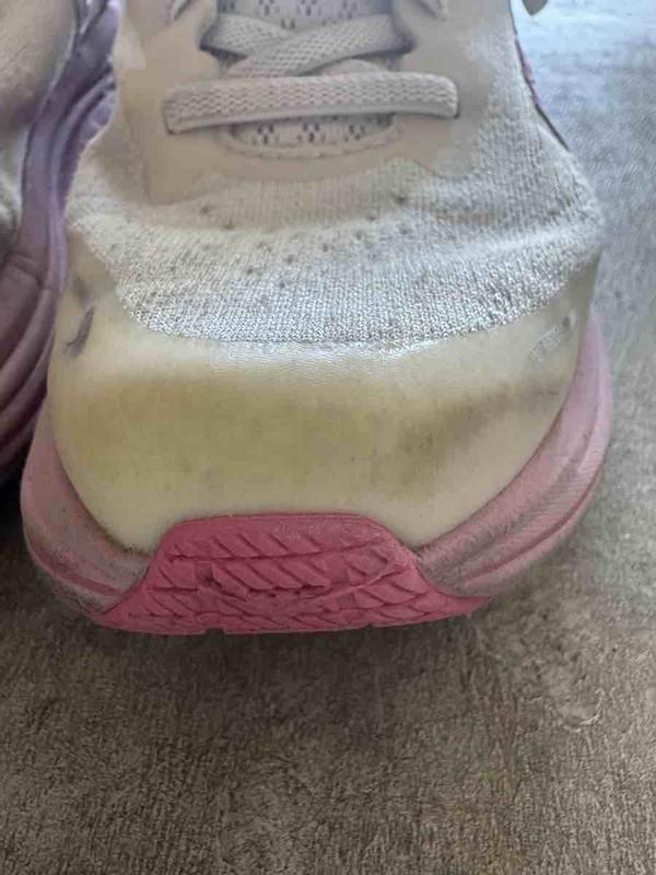 Customer photo for "Yellowing After Just a Few Months"