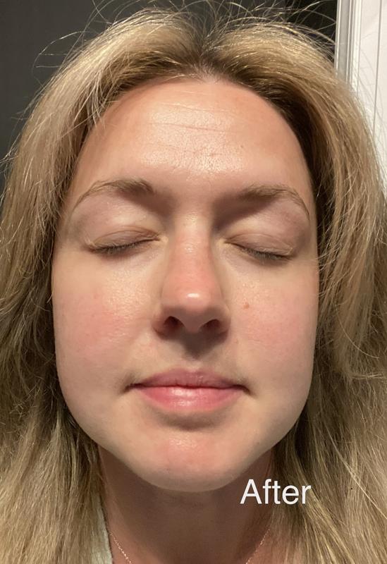 Customer photo for "Gives Skin a Beautiful, Dewy Glow"