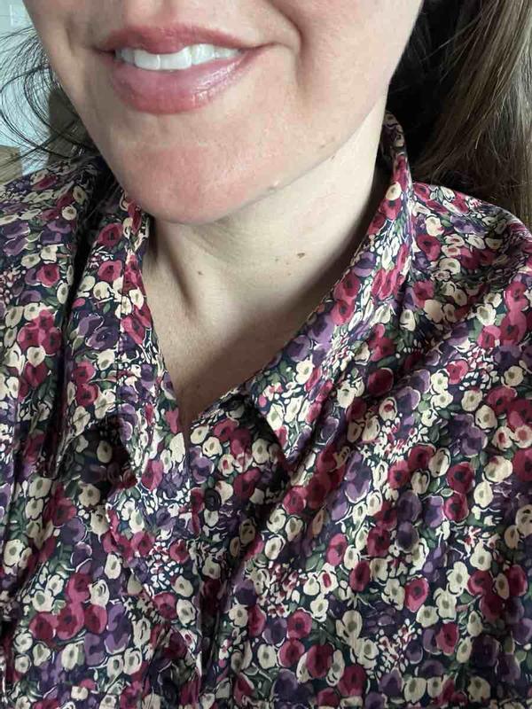 Customer photo for "Lovely Lip Enhancement yet Subtle"