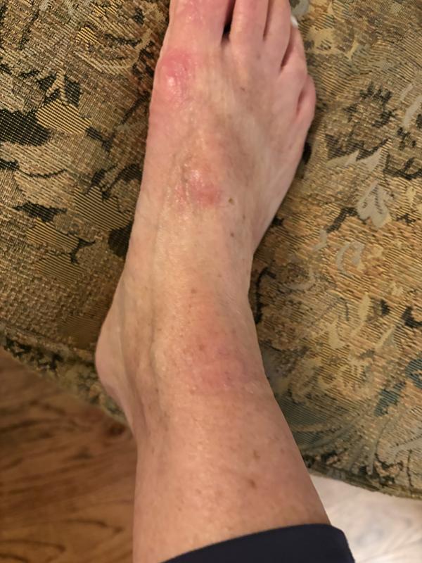 Customer photo for "Love them…but!"