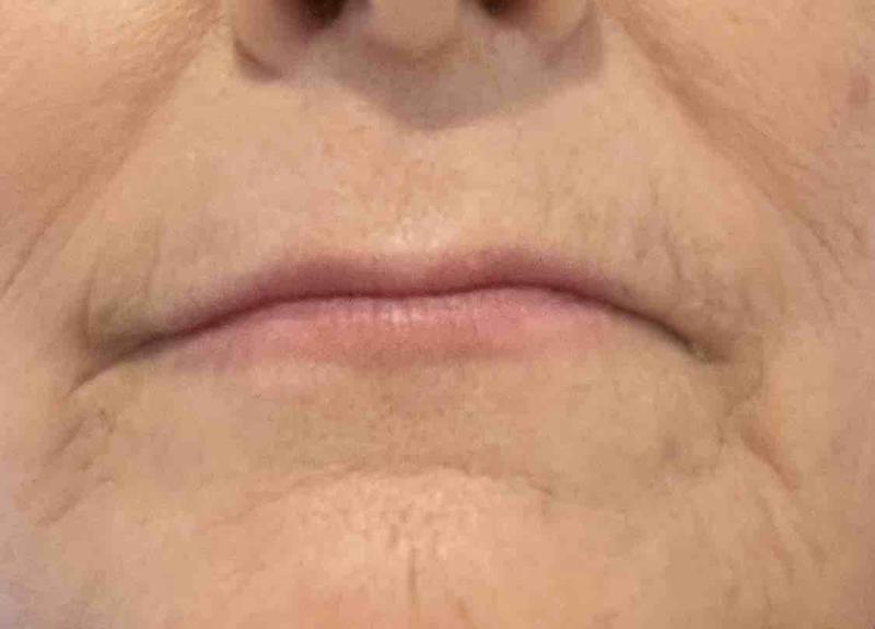 Review Thumbnail Image 0 224926590