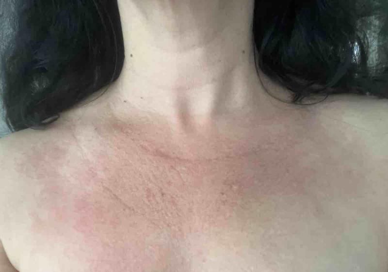 Review Thumbnail Image 0 237585402