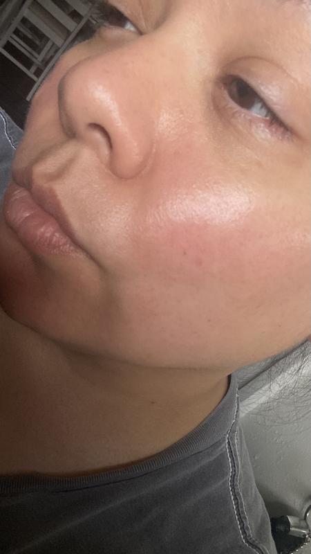 Customer photo for "Very nice serum"