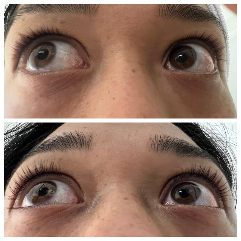 Customer photo for "Quick results"