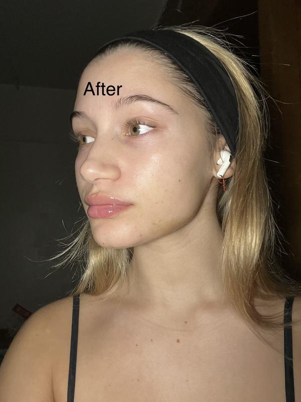 Review Thumbnail Image 1 221479194