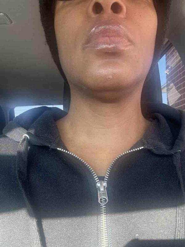 wow! unbelievable results