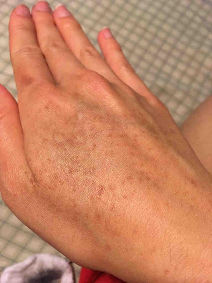 Review Thumbnail Image 1 204618988